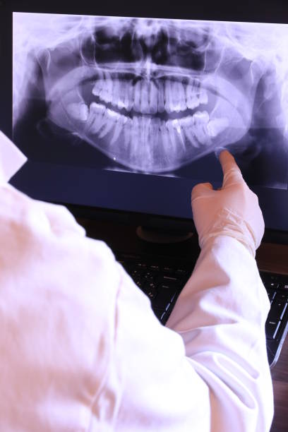Best Knocked-Out Tooth Emergency  in Fruit Cove, FL