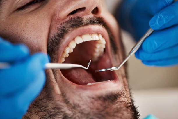 Best Dentist for Tooth Abscess  in Fruit Cove, FL